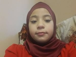 Фото: Aref Alshteiwi На фото: Девочку дразнили и называли уродливой